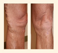 Varicose veins Clinic Image